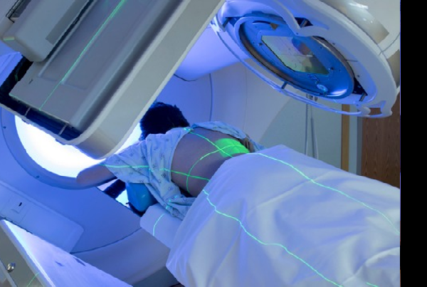 Image Guided Radiation therapy